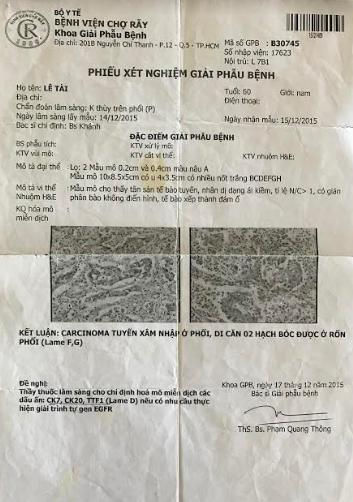 congly vn gap benh nhan ung thu thoat an tu nho bai thuoc nam gia truyen ba quynh hinh anh1